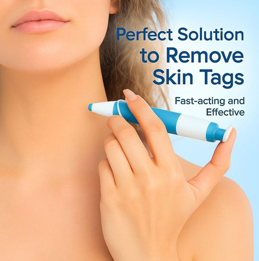 SkinTag Removal Kit -  Painless Remover Kit & No More Skin Tags (Acrochordons) in Less Than 14 Days!