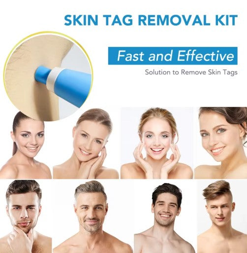 SkinTag Removal Kit -  Painless Remover Kit & No More Skin Tags (Acrochordons) in Less Than 14 Days!