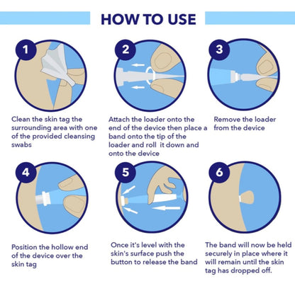 SkinTag Removal Kit -  Painless Remover Kit & No More Skin Tags (Acrochordons) in Less Than 14 Days!